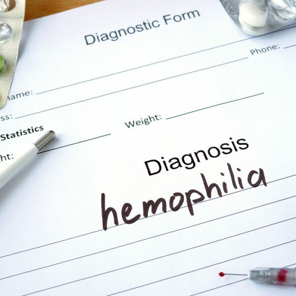 Hemophilia &#8211; Symptoms, Types, and Management Options