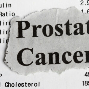 Stages, and Ways to Manage Prostate Cancer