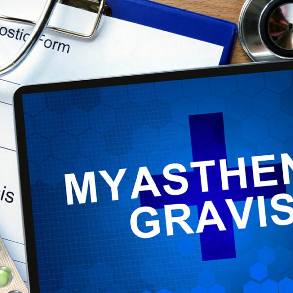 Top Therapies for Those With Myasthenia Gravis