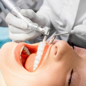 4 Medicare dental plans that cover your dental care