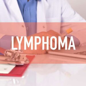 Best Treatment Options for Non Hodgkin Lymphoma