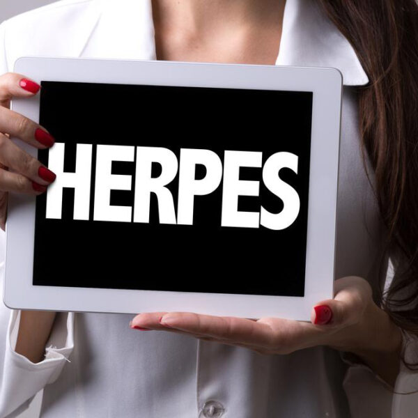 Effective alternative treatments to cure herpes