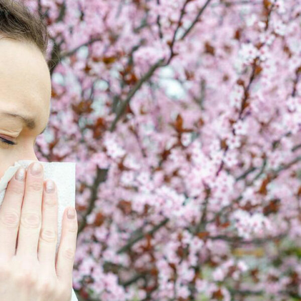 Here are some popular home remedies for Pollen Allergy