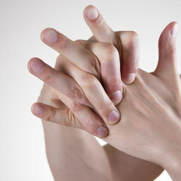 Here&#8217;s what you need to know about rheumatoid arthritis and lupus