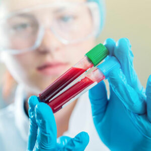 Here&#8217;s why maintaining normal creatinine levels is imperative