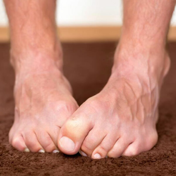 Important symptoms of neuropathy that should not be ignored