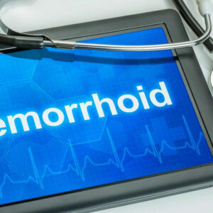 What are the causal factors of hemorrhoids?