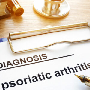 A guide to the symptoms of psoriatic arthritis