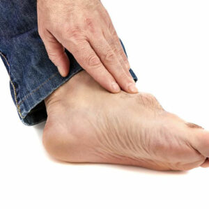 Gout &#8211; Causes, Symptoms, Treatment, and Diet Plans