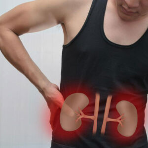 Do Not Ignore These Kidney Cancer Symptoms