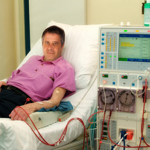 Essential Things to Know about Kidney Dialysis