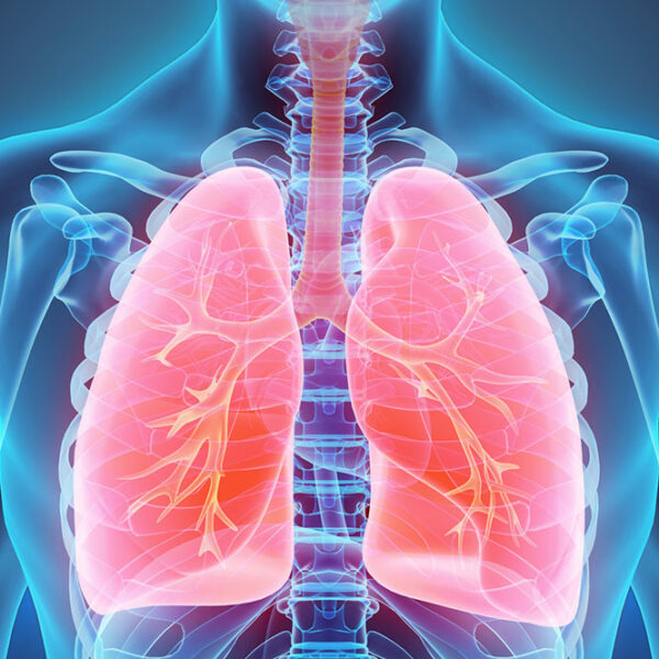 Everything you should know about lung cancer