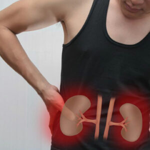 Kidney Failure &#8211; Causes and Symptoms