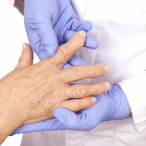 How to Detect the Early Signs of Rheumatoid Arthritis