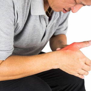 How to Treat Gout Symptoms Effectively