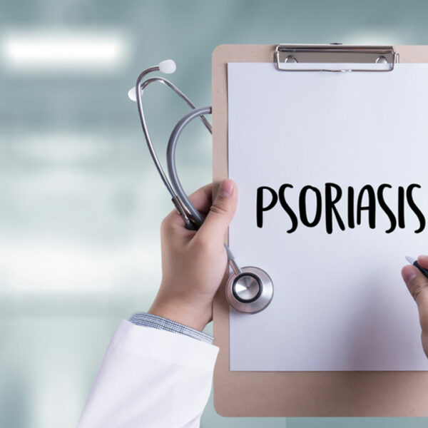 Here are Some Treatment Options for Psoriasis