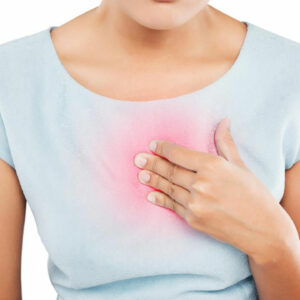 Important Things You Should Know About Heartburn Relief