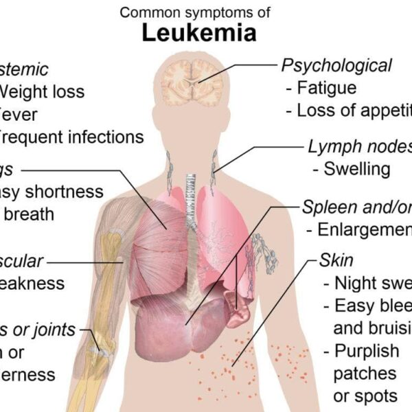 Is your Body Telling You About these Leukaemia Symptoms?