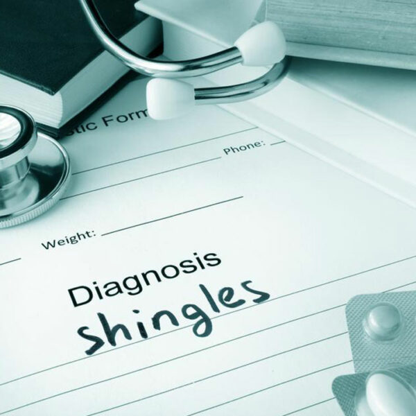 Natural Remedies for Shingles