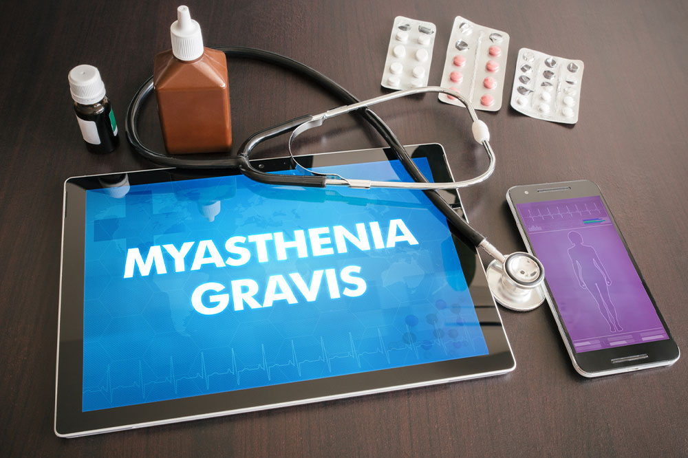 Myasthenia Gravis – Causes, Symptoms, and Prevention Methods